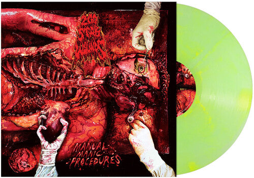 200 Stab Wounds - Manual Manic Procedures [Green / Yellow Marble Vinyl]